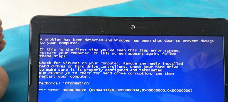 解决笔记本电脑蓝屏问题的有效方法（诊断和修复笔记本电脑蓝屏的常见错误）
